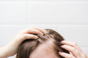 Scalp health treatment for hair growth at salon in Kelowna